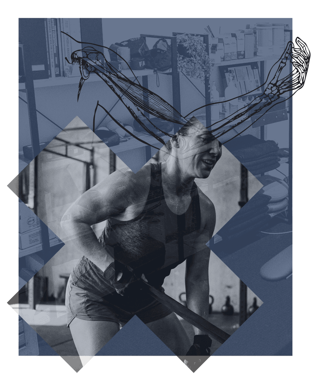 Rehabilitation at INVICTUS Sport & Spine, Bundall Gold Coast